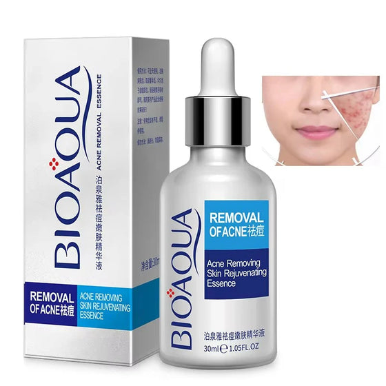 Bioaqua Anti-Acne Serum Removal Of Acne Essence Liquid 30ML BQY57621
