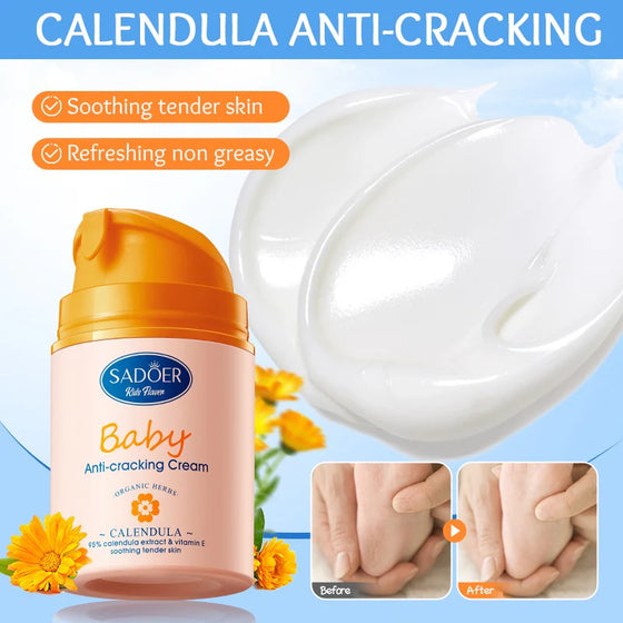 SADOER Baby Calendula Vitamin E Gentle Soothing Anti-Cracking Cream