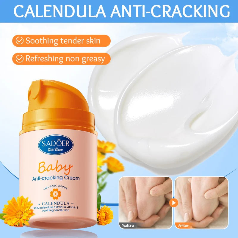 SADOER Baby Calendula Vitamin E Gentle Soothing Anti-Cracking Cream